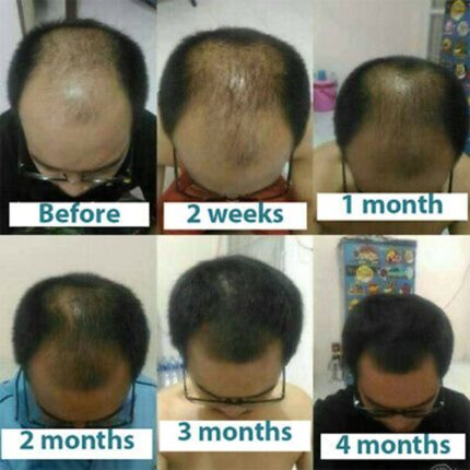 Neo Hair Lotion 120ml Hair Grow Serum Hair Growth Treatment Spray Thailand Original Products Essence Hair 1